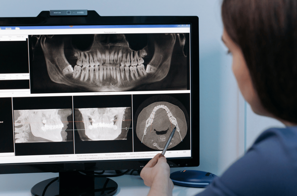 radiologia odontoiatrica